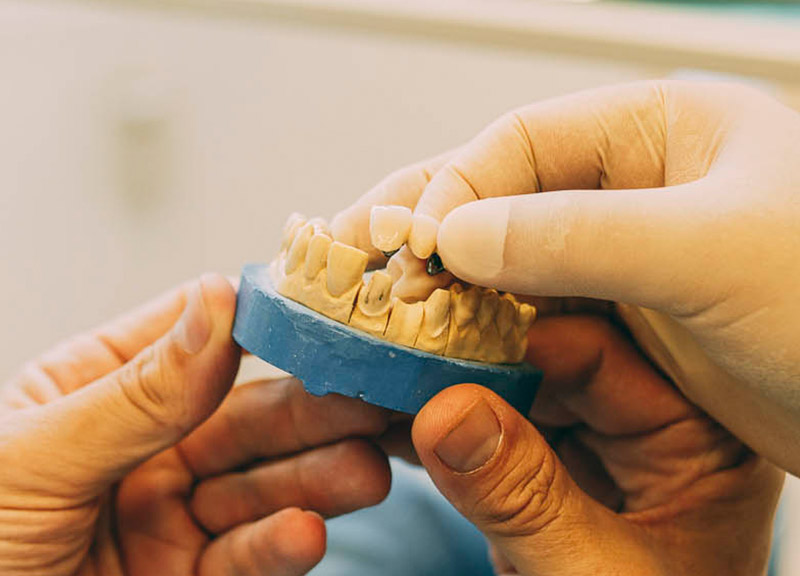 Zahnarzt zeigt Patienten Möglichkeiten für ästhetischen Zahnersatz Leverkusen